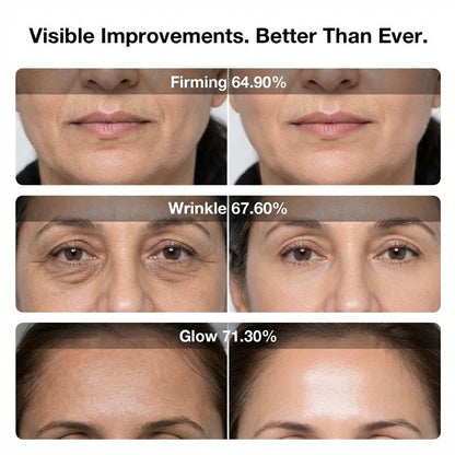 JUNO 6D Laser & EMS Anti-Aging Therapy Mask