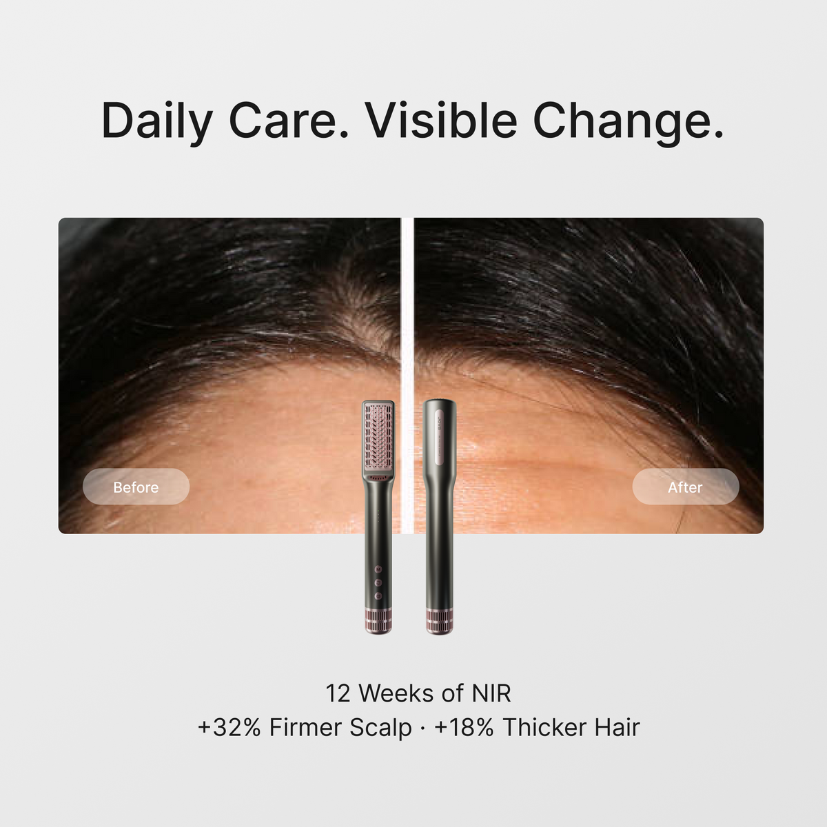 JUNO HLLT Hair Density Dryer