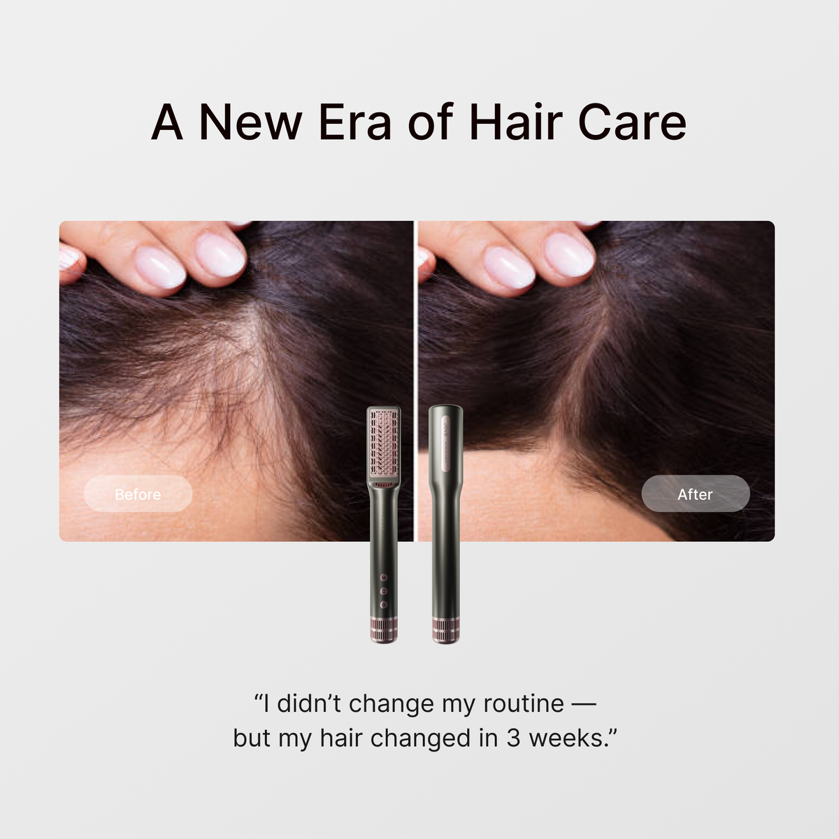 JUNO HLLT Hair Density Dryer