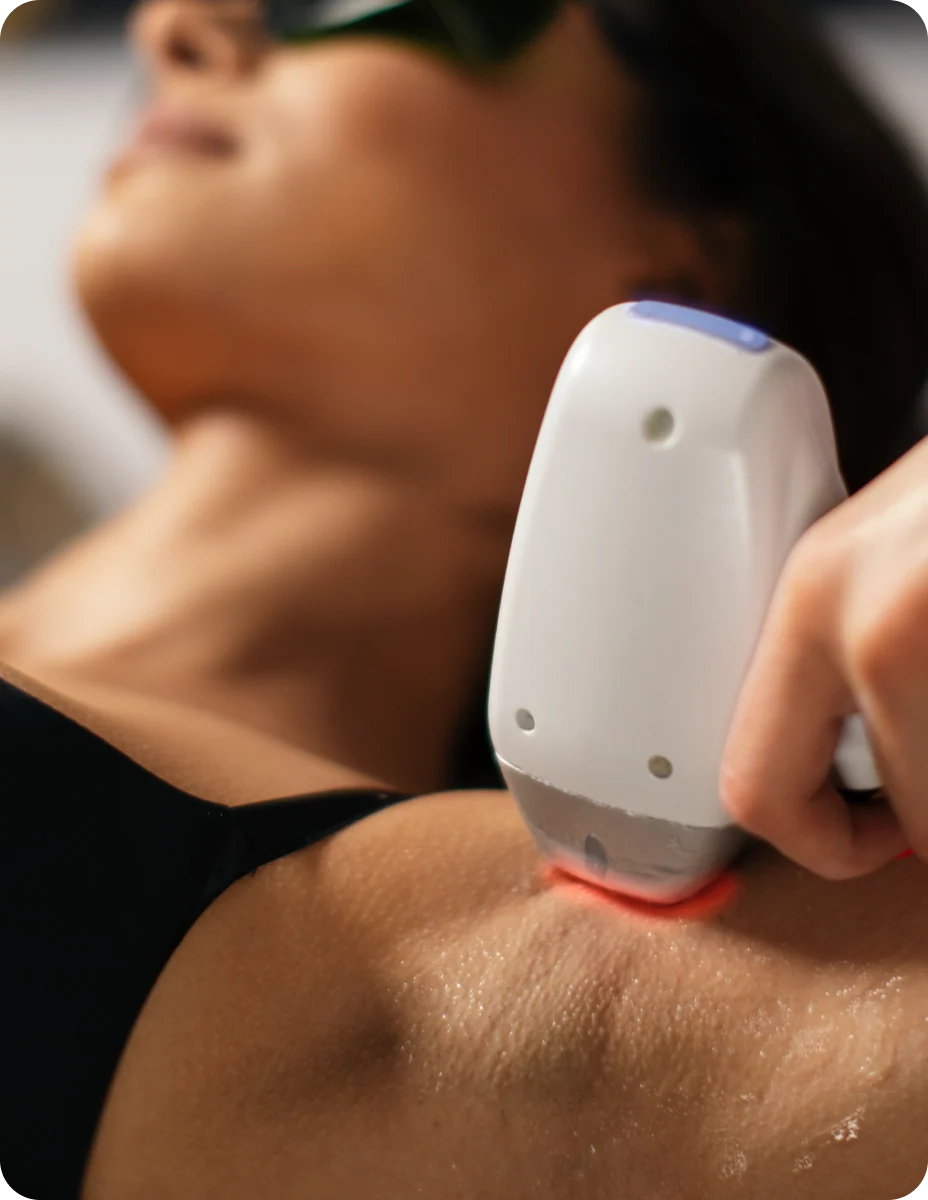 Hair Removal