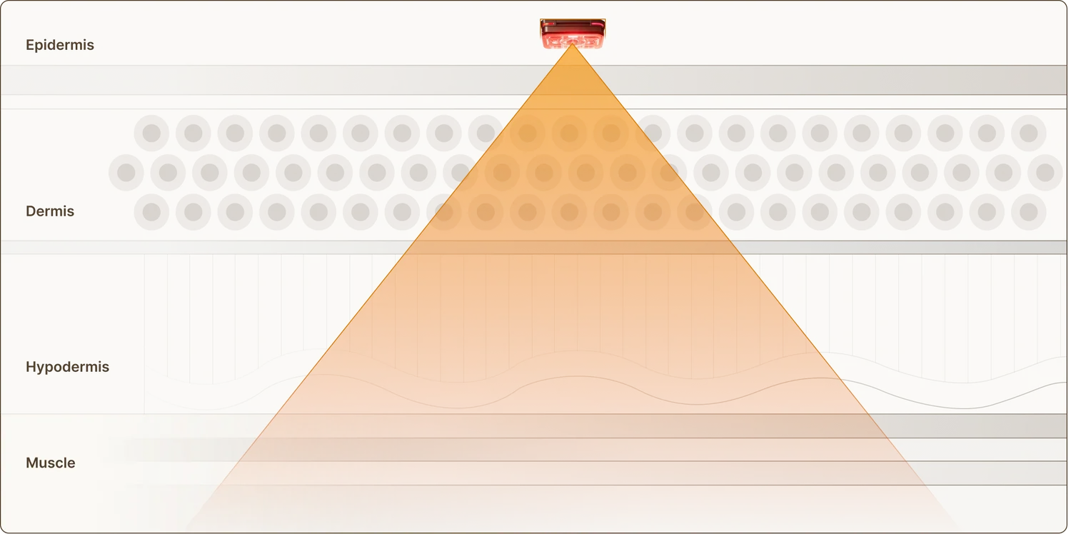 1000 – 1200 nm skin penetration